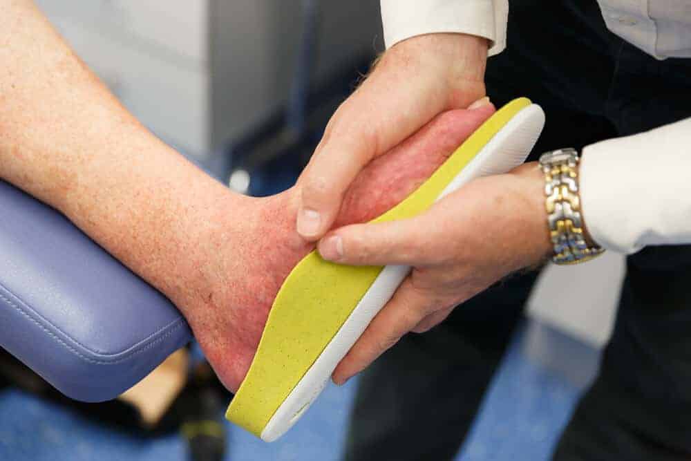 Custom Footwear insoles being fitted on a person's foot