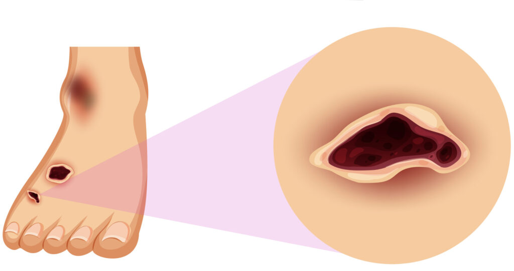diabetic foot problems
