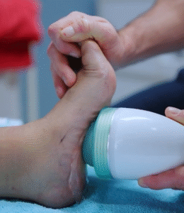 Shock Wave Therapy