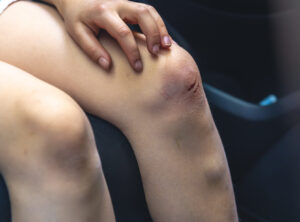 diabetic foot problems