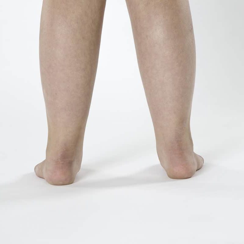 Back view of a person's leg