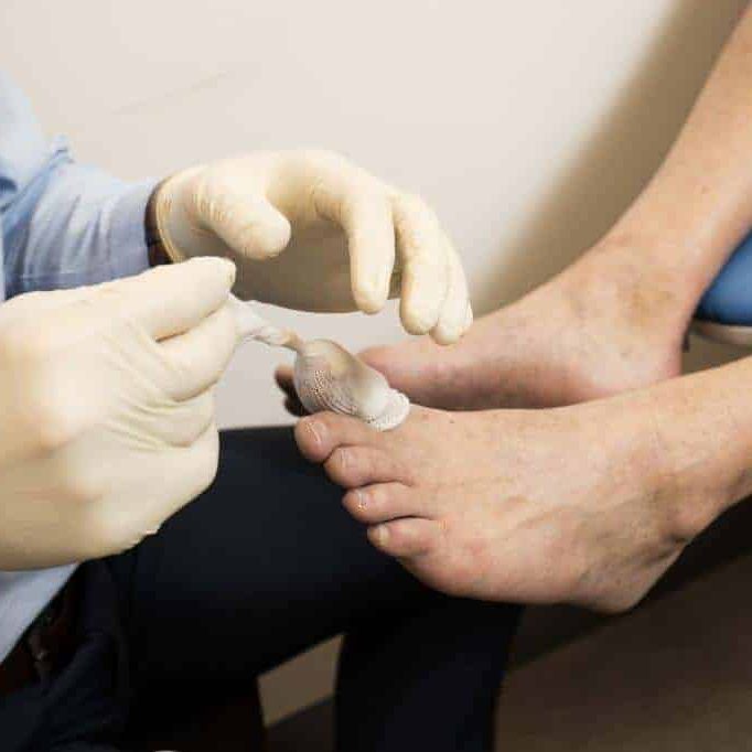 Ingrown Toe Nails being manageed by a Podiatrist