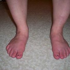 a snapshot of a feet